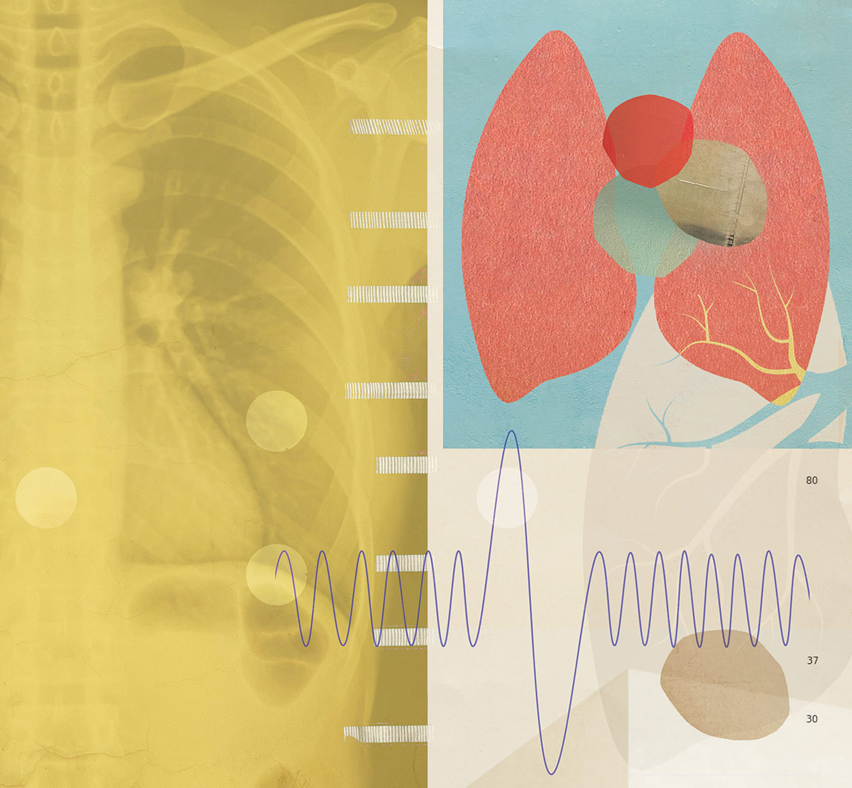 Abstract medical graphic featuring a chest X-ray next to an illustration of human lungs and a heart rhythm line.